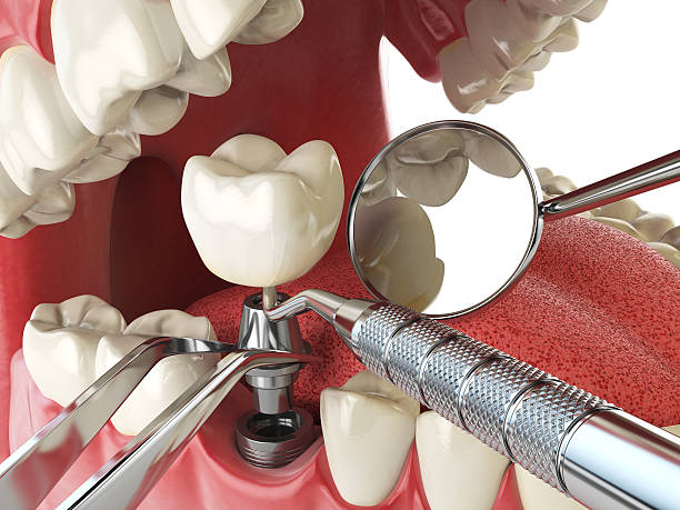 Best Emergency Dental Care for Broken or Chipped Teeth in Batesville, AR
